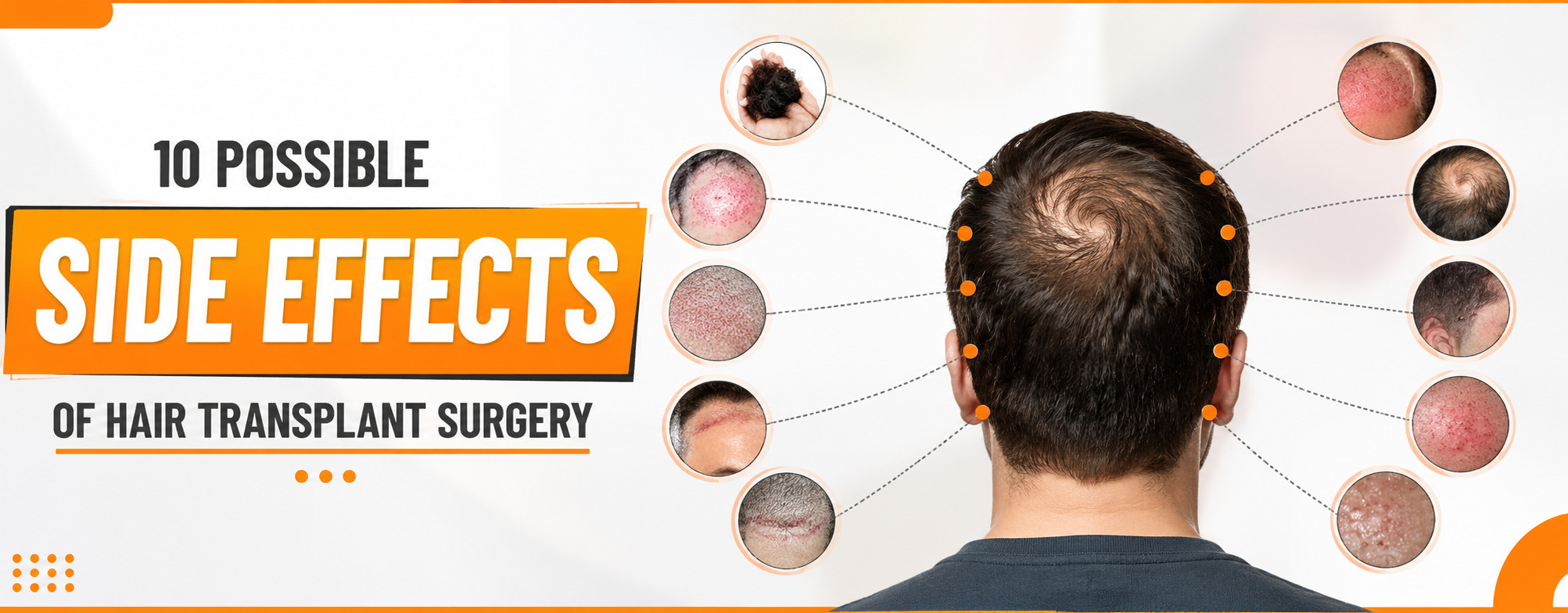 Hair Treatment Side Effects: What to Expect at Every Stage