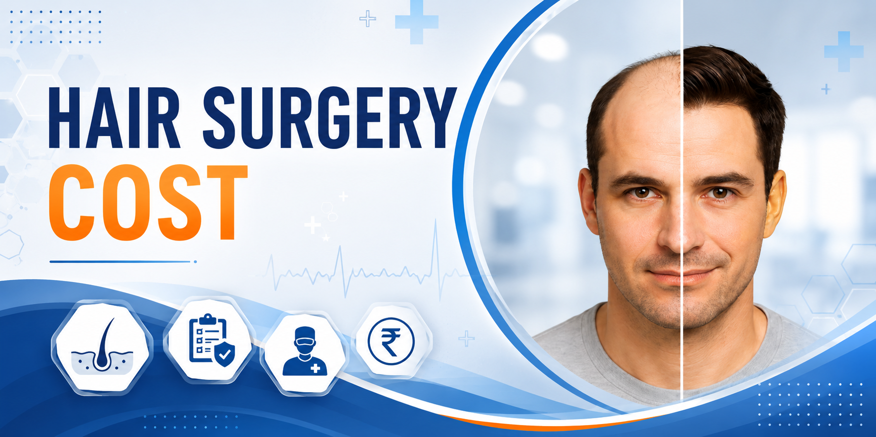 Hair Transplant Surgery Cost: Complete Price Guide (2026)