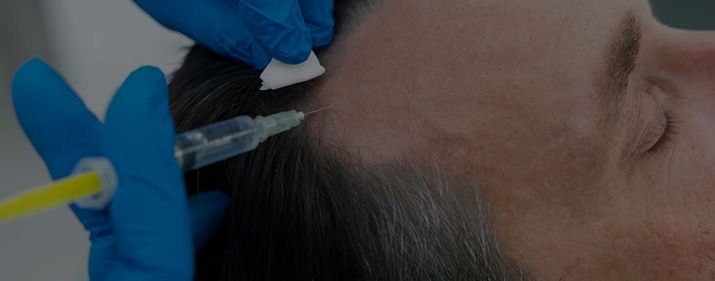 Hair Transplant